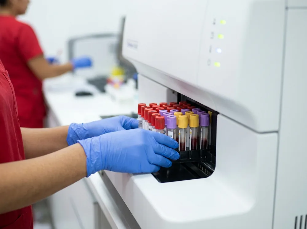Monitoreo biológico en el laboratorio clínico ocupacional Bacterióloga cargando tubos de muestra en el analizador del laboratorio para monitoreo biológico